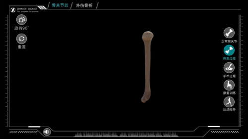 反肩手術(shù)模擬