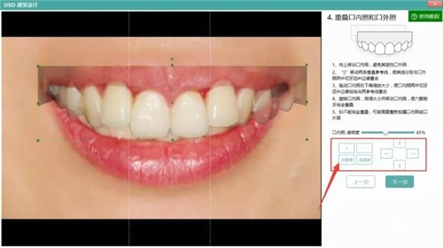 牙醫(yī)管家口腔管理軟件截圖