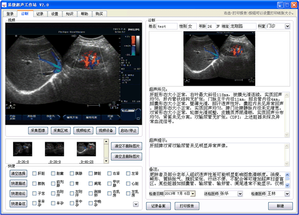 易捷超声工作站