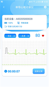 星康心電截圖